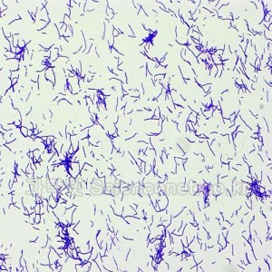 간균(Gram Positive-Bacillus)슬라이드