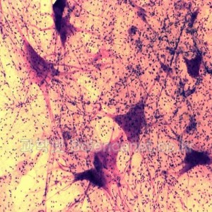 신경세포(뉴런)슬라이드